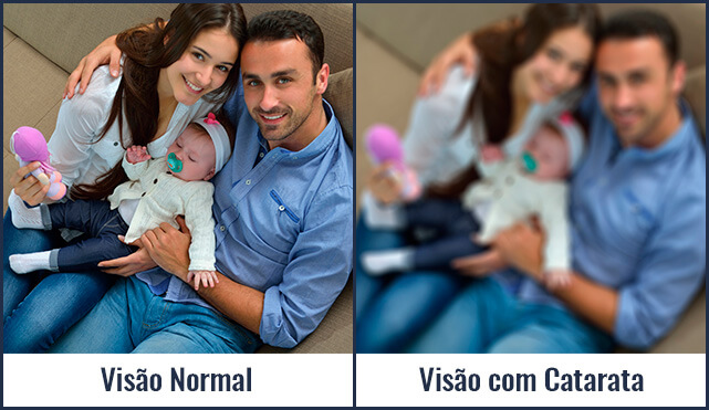 Comparação de visão sem e com catarata